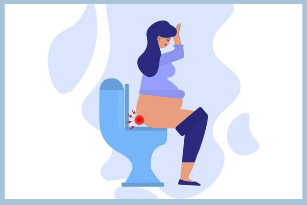 Bệnh trĩ sau sinh: nguyên nhân và cách xử lý an toàn, hiệu quả 