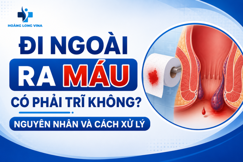 Đi ngoài ra máu có phải trĩ không? Nguyên nhân và cách xử lý