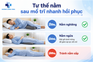 Tư thế nằm sau mổ trĩ nhanh hồi phục