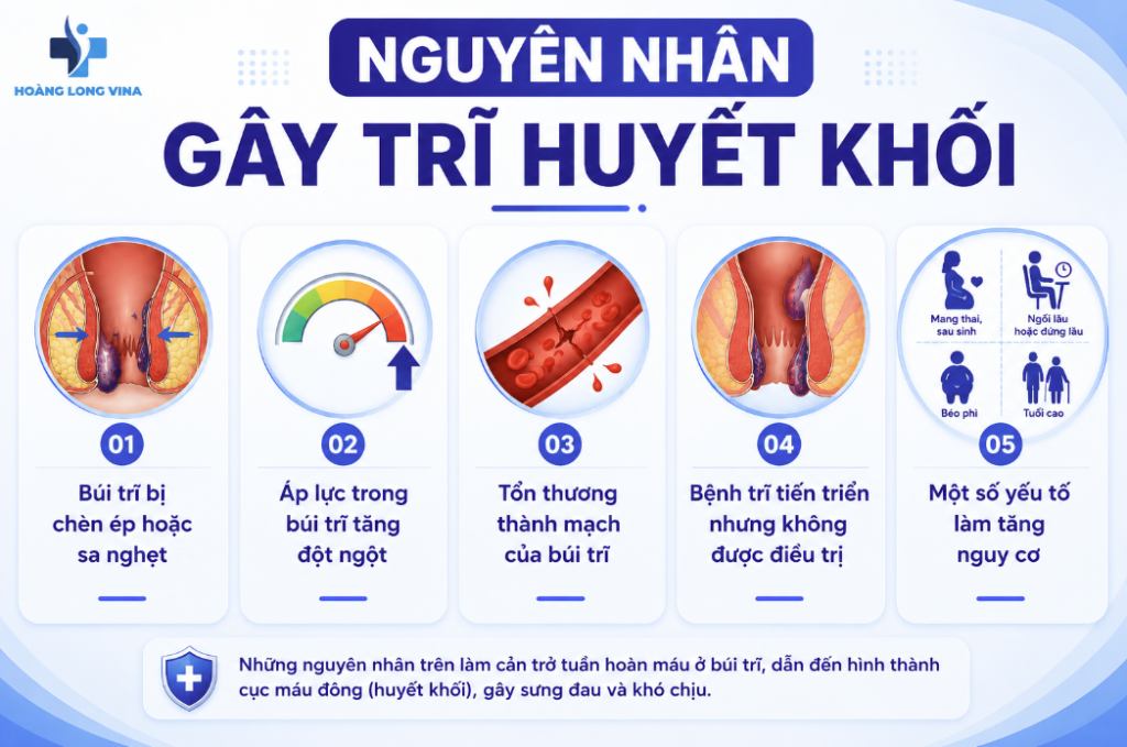 Nguyên nhân gây trĩ huyết khối