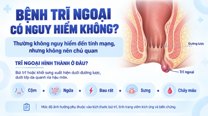 Bệnh trĩ ngoại có nguy hiểm không?