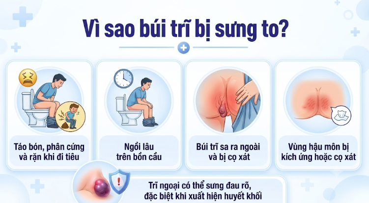 Vì sao búi trĩ bị sưng to?