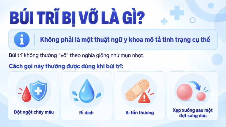 Búi trĩ bị vỡ là gì?