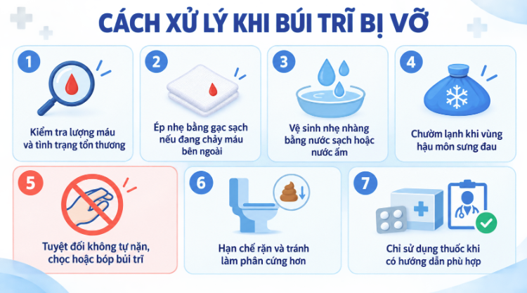Cách xử lý khi búi trĩ bị vỡ