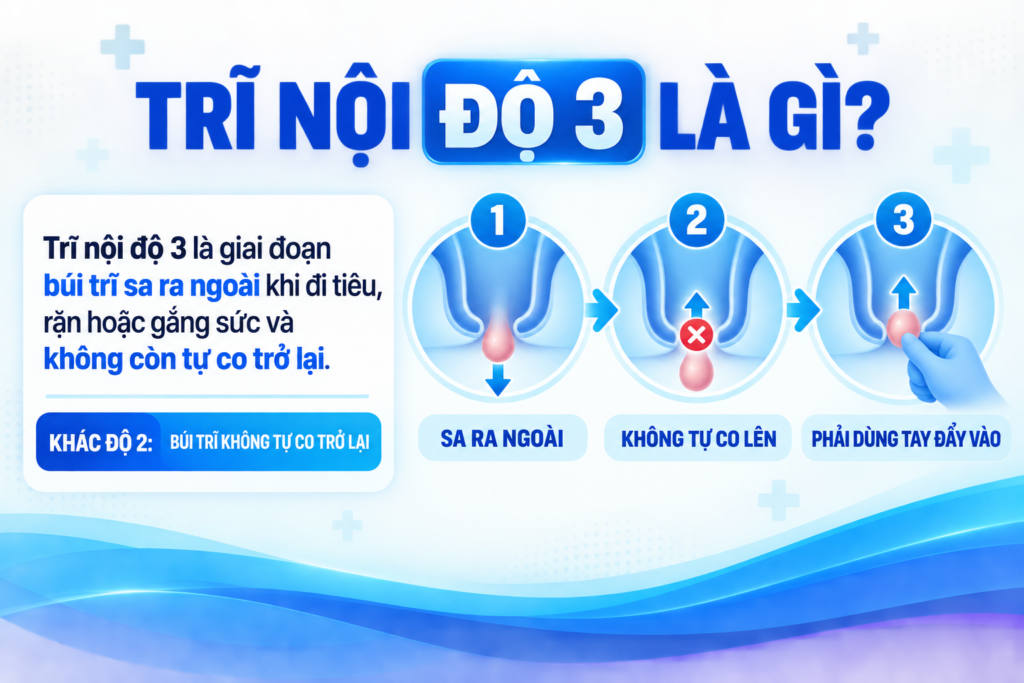 Trĩ nội độ 3 là gì?